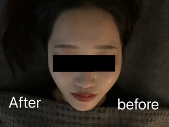 アンサー(ANSWER)/一度で分かる小顔矯正