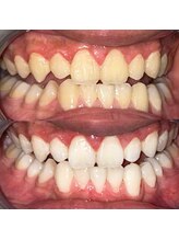 ライトビューティー 池袋店(LightBeauty)/症例写真