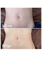 サロンドビオ(Salon de vio)/温腸活