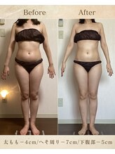 エソール(essor)/運動なしでもスッキリ痩せ！