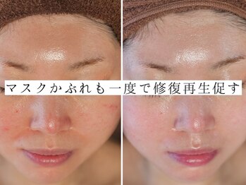 ユウビジン(YOU美人)/