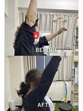 上六ミューク整体院/五十肩もお手のもの