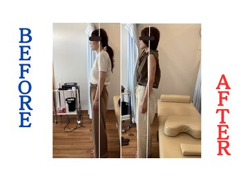 たかす整骨院/肩こり/ストレートネック/猫背