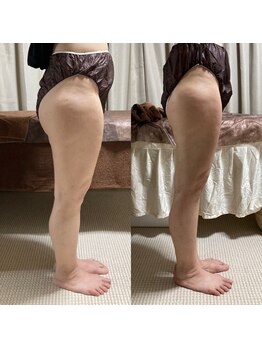 リラチル(relachill)/筋膜リリース（下半身）