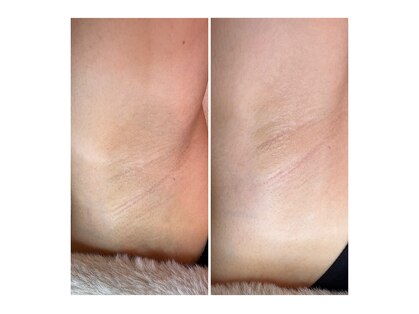 ソワンドボーテ クー(Soin de Beaut'e Quu)の写真