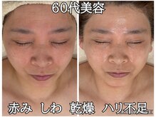 リンダ(Rinda)の雰囲気（年齢問わない肌質改善!クリスティーナ6ライン/韓国肌管理）