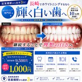 ホワイトニングショップ 長崎店