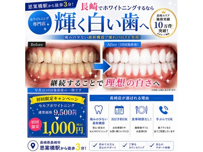 ホワイトニングショップ 長崎店の写真