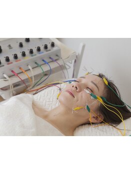 鍼灸施術を受けたい