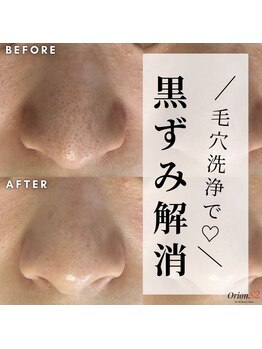 オリオンドットエスツー(Orion.S2)/【Before→After】