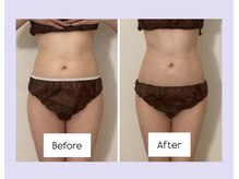 ミヌレ 京都店(minulle)/腸もみ&肋骨締め