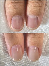 シュシュ(shou shou)/自爪育成