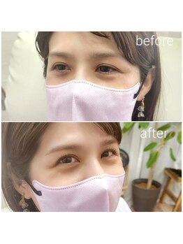 ビメ 中央林間(BEME)/before・after