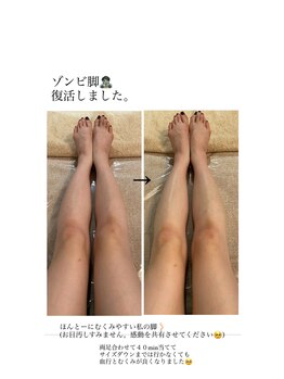 アエレ(AEREE retreat salon)/むくみ・冷えの解消に◎