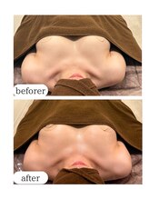 ワム(Wom)/枚方バストサロン/下垂