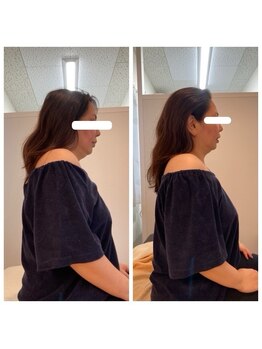 ランファビューティー(蘭花Beauty)/小顔矯正 《沖縄/宜野湾》