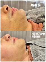 ワイズサロン(Y's salon)/7回終了から2週間後