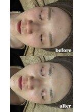 エクラ(ECLAT)/クールビタミン導入♪