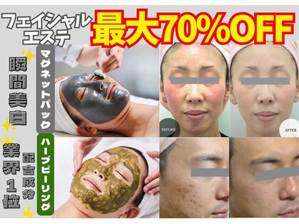 インナーメス(INNER MES)の写真