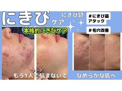 ミライ(Mirai)の写真