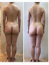 カロン(Kalon)/痩身