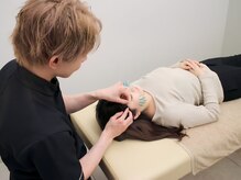 にしもと整骨院 鍼灸院 福島院/EMS美容鍼