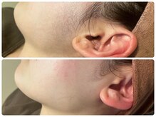 ブリリアント(Brilliant)/お顔シェービング