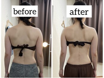 フェリス(Feliz)/結果重視の痩身