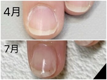 グレースレディ 神戸北店/