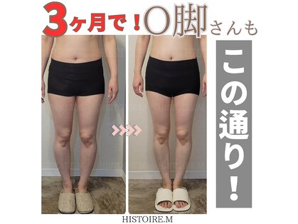 イストアールエム(HISTOIRE.M)の写真