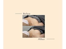 オベリオ(OBERIO)/