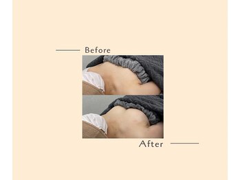 オベリオ(OBERIO)/