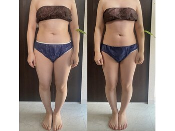 インナーメス(INNER MES)/【一番人気】全身徹底痩身!