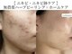 ラ フォルポ 恵比寿(La forepos)の写真