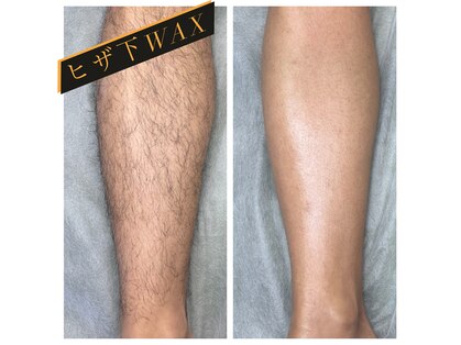 エピリア(Epilear)の写真