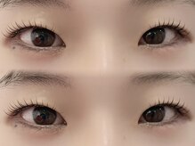 シャローム アローヴ(shalom alob)/奥二重、一重さんお任せ下さい