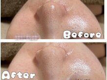 グラシア 倉敷店(Gracia)/お客様の施術事例