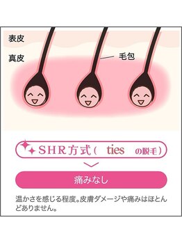 タイズ ヘアーリムーバルアンドアイラッシュ(ties)/タイズの最新SHR方式脱毛★