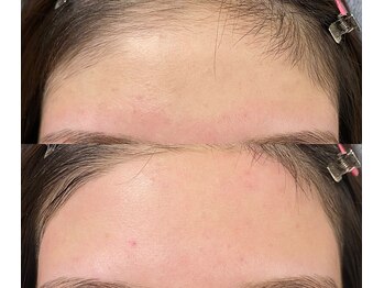 アイブロウサロン ミラ(Eyebrow Salon Mira)/額ワックスケア