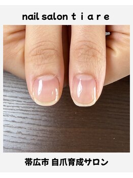 ティアレ(tiare)/自爪育成【クリア】