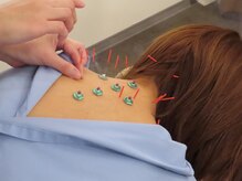 ビゴー鍼灸院 円山院(bigo鍼灸院)の雰囲気（国家資格保有スタッフ在籍院で初めての鍼灸×整体を応援！）