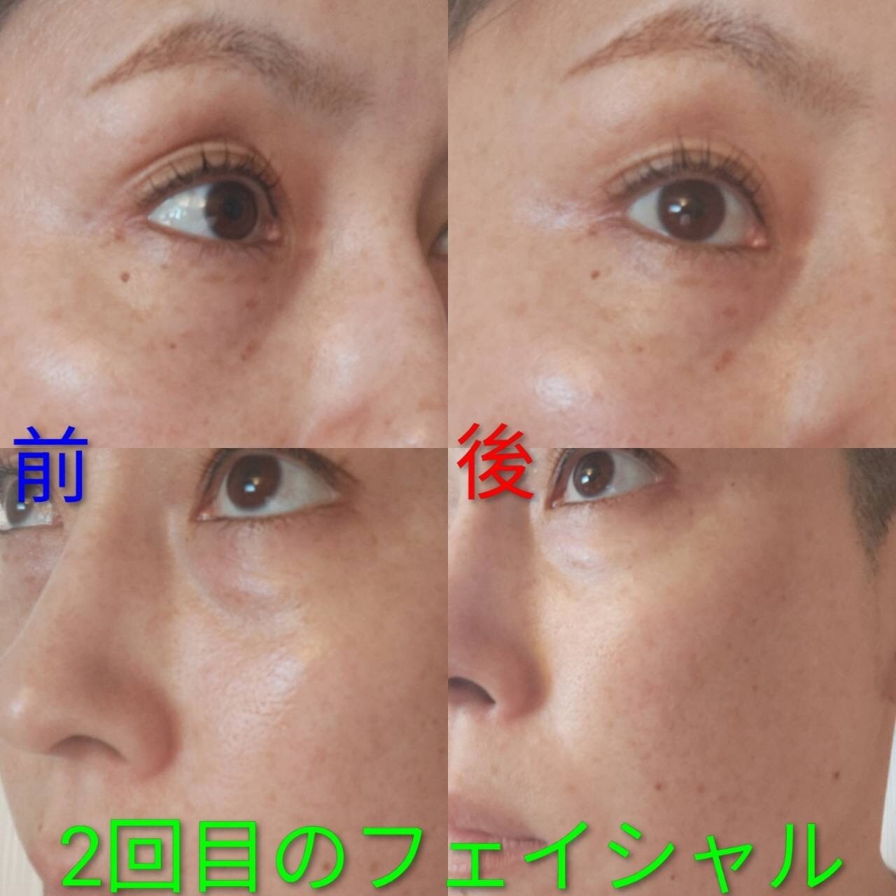 フォト｜インディバサイタマックス(INDIBA SAITAMAX)｜ホットペッパー