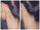 シェービングエステティックサロン エアル(Earu)の写真