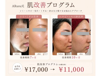 アルルプラス 南草津(ARuru+)の写真