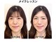 アマルジーナ(AmalZwina)の写真