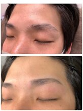 ソラ(sora)/ビフォーアフター