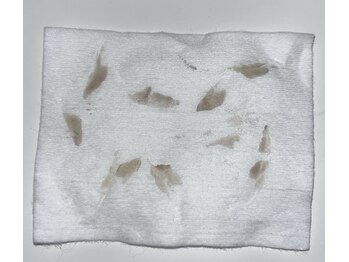 アットウィル 志木店(at will)/お顔の汚れ、古い角質!!