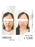 【二重顎/ほうれい線】潤いスキンケアコース+低周波リフト65分¥7700→￥5500
