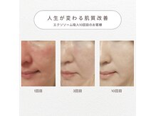 美道(BIDOU)の雰囲気（肌のお悩みを改善して潤い、ハリのあるお肌へ）