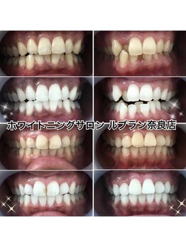 ルブラン 奈良店(Le Blanc)/夏本番までに!!